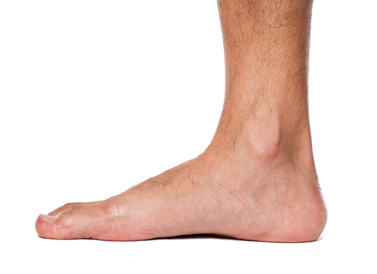 Mycose du pied :   comment la reconnaître?